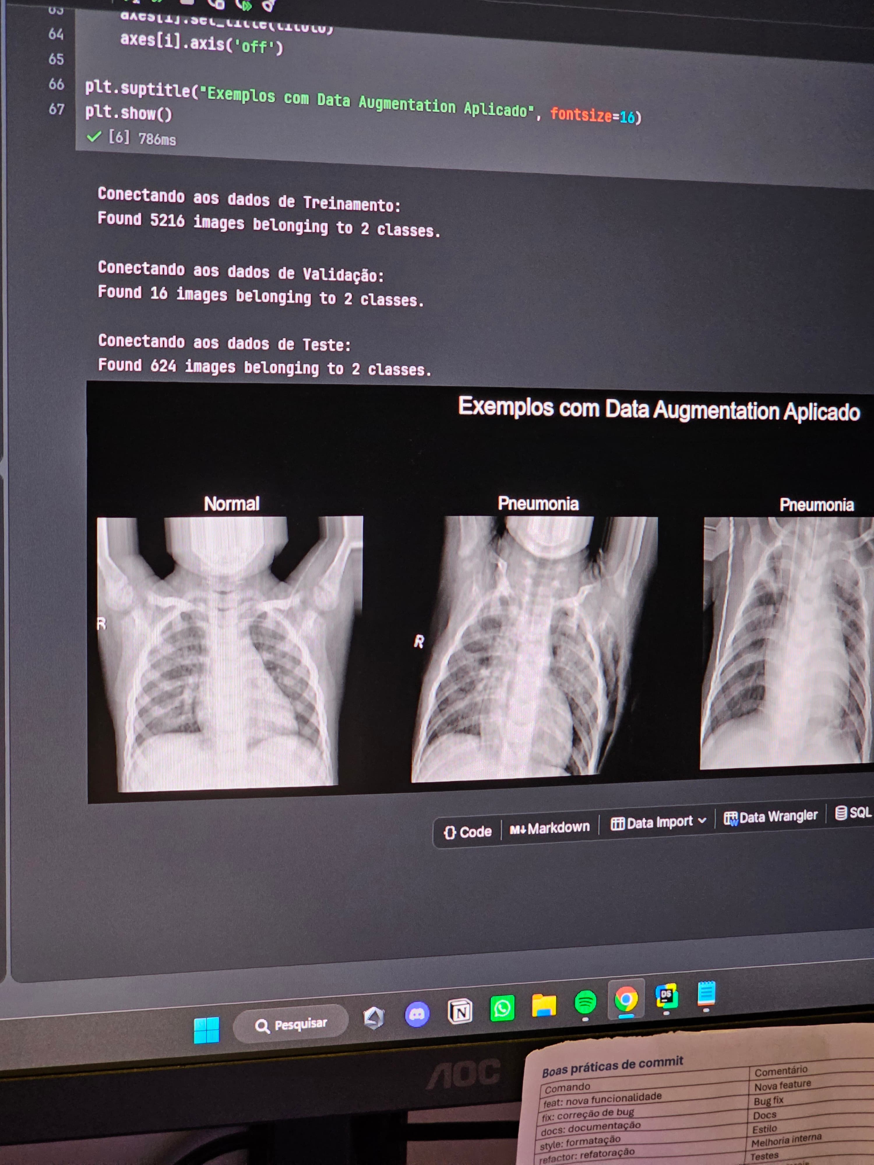Detecção de Pneumonia em Raios-X com Deep Learning